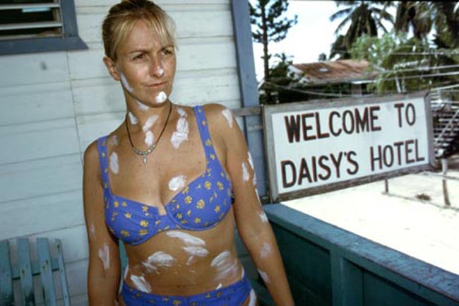 calamine